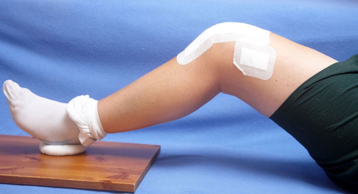 повреда колена као узрок артрозе